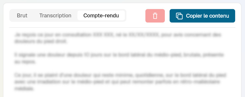 Interface des modes de transcription