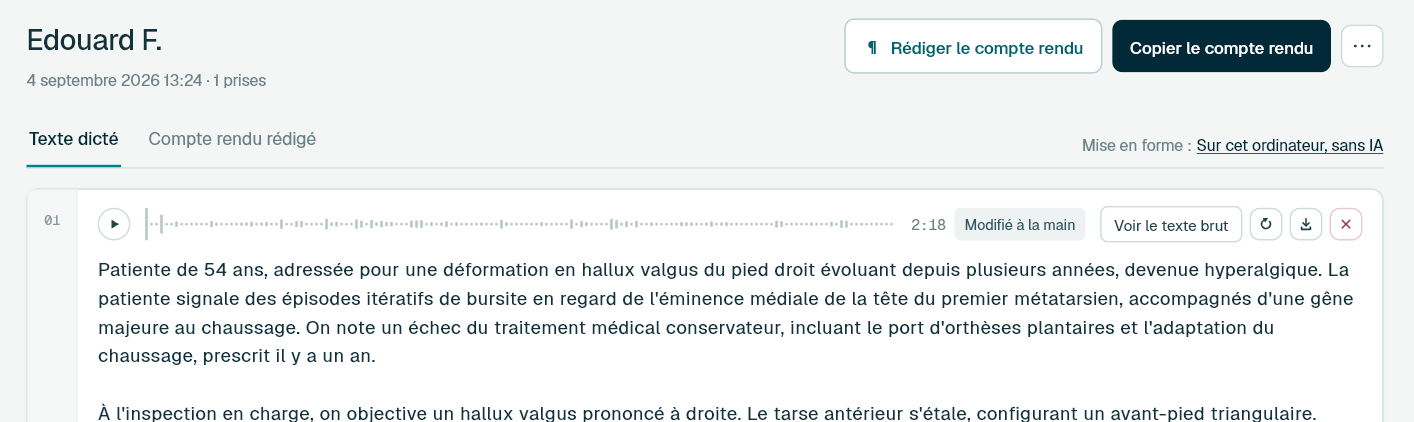 Interface des modes de transcription