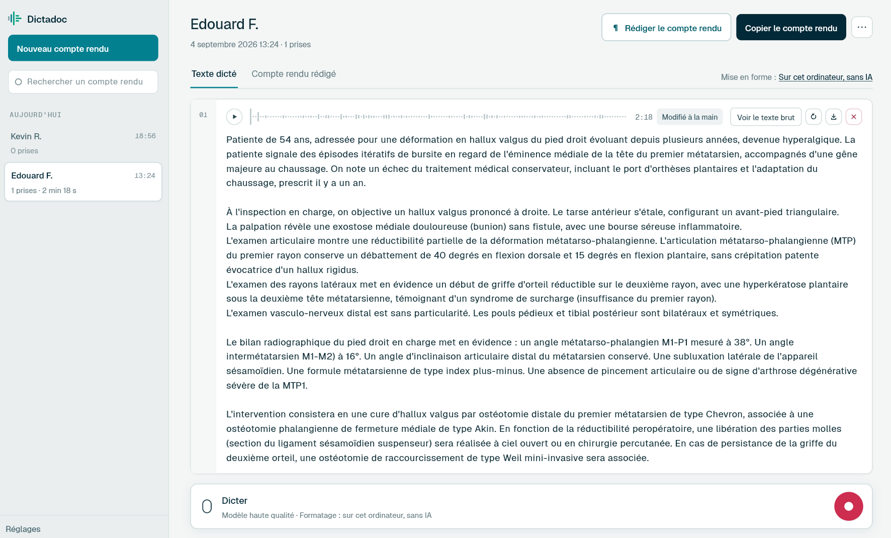 Dictadoc, un compte rendu et son enregistrement